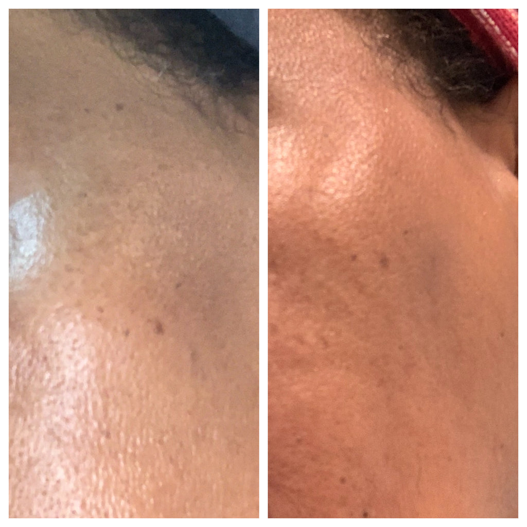 EGF High Potency Spray