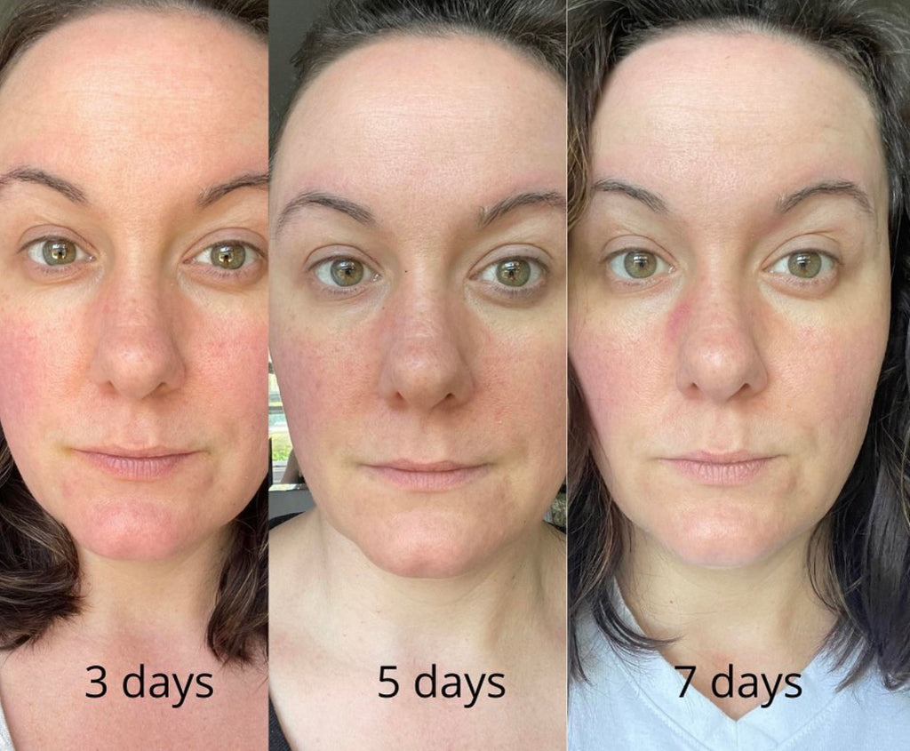 EGF Glow Trial Kit - Results in two weeks!